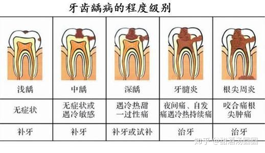 我在長沙市口腔醫院補牙全過程及經驗分享(圖6) 我在長沙市口腔醫院補牙全過程及經驗分享(圖6)